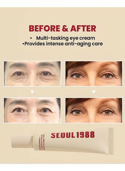 SEOUL 1988 - 4% Retinal Liposome Eye Cream